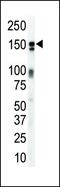 Erb-B2 Receptor Tyrosine Kinase 3 antibody, GTX25470, GeneTex, Western Blot image 