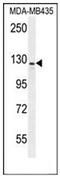 Inhibitor Of Bruton Tyrosine Kinase antibody, AP52138PU-N, Origene, Western Blot image 