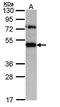 Translocating chain-associated membrane protein 1 antibody, orb69818, Biorbyt, Western Blot image 