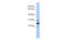 Adenylate Kinase 1 antibody, 26-286, ProSci, Western Blot image 