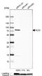 Kinesin Light Chain 2 antibody, NBP1-83723, Novus Biologicals, Western Blot image 