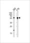 Aldehyde Dehydrogenase 1 Family Member A3 antibody, 63-239, ProSci, Western Blot image 