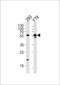 Aldehyde dehydrogenase family 1 member A3 antibody, 63-239, ProSci, Western Blot image 