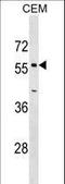Optineurin antibody, LS-C158444, Lifespan Biosciences, Western Blot image 