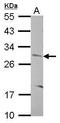 CCR4-NOT Transcription Complex Subunit 8 antibody, GTX105674, GeneTex, Western Blot image 