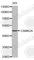Calcium/Calmodulin Dependent Protein Kinase II Alpha antibody, A0585, ABclonal Technology, Western Blot image 