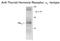 Thyroid Hormone Receptor Alpha antibody, GTX82579, GeneTex, Western Blot image 