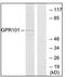 G Protein-Coupled Receptor 101 antibody, AP31882PU-N, Origene, Western Blot image 