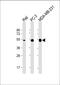 Matrix Metallopeptidase 1 antibody, M00733-1, Boster Biological Technology, Western Blot image 