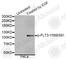 Fms Related Tyrosine Kinase 3 antibody, AP0529, ABclonal Technology, Western Blot image 