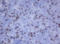 CD2 Molecule antibody, LS-C788933, Lifespan Biosciences, Immunohistochemistry frozen image 