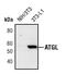Patatin Like Phospholipase Domain Containing 2 antibody, PA5-17436, Invitrogen Antibodies, Western Blot image 