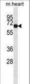 AarF Domain Containing Kinase 1 antibody, LS-C164290, Lifespan Biosciences, Western Blot image 