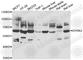 Dual Specificity Tyrosine Phosphorylation Regulated Kinase 2 antibody, A7012, ABclonal Technology, Western Blot image 