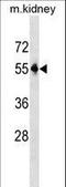 Patatin Like Phospholipase Domain Containing 3 antibody, LS-C158236, Lifespan Biosciences, Western Blot image 