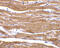 Beta-secretase 2 antibody, 2247, QED Bioscience, Immunohistochemistry paraffin image 