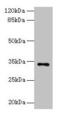 N-Acetyltransferase 2 antibody, CSB-PA015471LA01HU, Cusabio, Western Blot image 