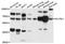 Activin A Receptor Like Type 1 antibody, LS-C408352, Lifespan Biosciences, Western Blot image 