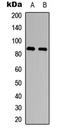ADAM Metallopeptidase Domain 8 antibody, LS-C354312, Lifespan Biosciences, Western Blot image 