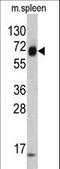 Keratin 4 antibody, LS-C165630, Lifespan Biosciences, Western Blot image 