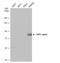 HNF1 Homeobox A antibody, NBP1-33596, Novus Biologicals, Western Blot image 