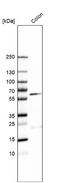 Beta-1,4 N-acetylgalactosaminyltransferase 2 antibody, NBP1-91229, Novus Biologicals, Western Blot image 