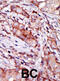 Calcium And Integrin Binding Family Member 2 antibody, abx033921, Abbexa, Immunohistochemistry paraffin image 
