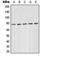 Protein Kinase C Delta antibody, orb214442, Biorbyt, Western Blot image 