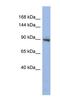 Zinc Finger Protein 546 antibody, NBP1-80191, Novus Biologicals, Western Blot image 