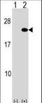 ADP Ribosylation Factor 5 antibody, LS-C156451, Lifespan Biosciences, Western Blot image 