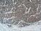 Fibroblast Growth Factor 3 antibody, 27100-1-AP, Proteintech Group, Immunohistochemistry frozen image 