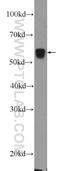 Propionyl-CoA Carboxylase Subunit Beta antibody, 11139-1-AP, Proteintech Group, Western Blot image 