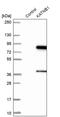 Katanin Regulatory Subunit B1 antibody, PA5-59750, Invitrogen Antibodies, Western Blot image 