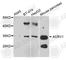 Acrosomal Vesicle Protein 1 antibody, A8098, ABclonal Technology, Western Blot image 