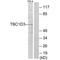 TBC1 Domain Family Member 3 antibody, A10516, Boster Biological Technology, Western Blot image 