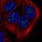 Double Zinc Ribbon And Ankyrin Repeat Domains 1 antibody, HPA064255, Atlas Antibodies, Immunofluorescence image 