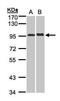 Interleukin 12 Receptor Subunit Beta 2 antibody, GTX103166, GeneTex, Western Blot image 