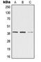 Zinc Binding Alcohol Dehydrogenase Domain Containing 2 antibody, MBS820624, MyBioSource, Western Blot image 