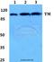 Thrombomodulin antibody, A01325-1, Boster Biological Technology, Western Blot image 