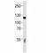 Complement C6 antibody, F49975-0.4ML, NSJ Bioreagents, Immunohistochemistry paraffin image 