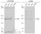 Insulin Receptor Substrate 2 antibody, GTX133760, GeneTex, Western Blot image 