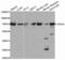 Succinate Dehydrogenase Complex Flavoprotein Subunit A antibody, abx002028, Abbexa, Western Blot image 