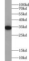 Zinc Finger CCCH-Type Containing 8 antibody, FNab09605, FineTest, Western Blot image 