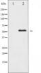 ABL Proto-Oncogene 1, Non-Receptor Tyrosine Kinase antibody, TA325197, Origene, Western Blot image 