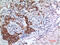 SMAD Family Member 3 antibody, GTX34209, GeneTex, Immunohistochemistry paraffin image 