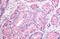 Somatostatin Receptor 1 antibody, MBS243532, MyBioSource, Immunohistochemistry frozen image 