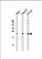Tetraspanin 31 antibody, PA5-72535, Invitrogen Antibodies, Western Blot image 