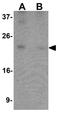 B9 Domain Containing 1 antibody, GTX32055, GeneTex, Western Blot image 