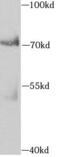 Apoptosis Inducing Factor Mitochondria Associated 3 antibody, FNab00236, FineTest, Western Blot image 