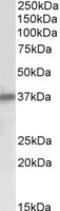 Sarcoglycan Delta antibody, MBS422642, MyBioSource, Western Blot image 
